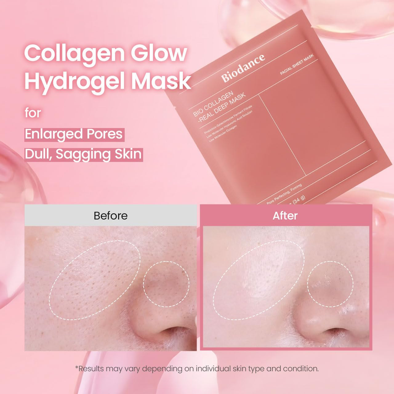 Bio-Collagen Hydrogel Face Mask Set – Overnight Hydrating Treatment, Pore Minimizing & Skin Plumping Formula, Korean-Inspired Skin Care, 4-Pack